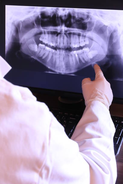 Best Emergency Root Canal Treatment in Phillipsburg, NJ